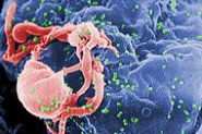 HIV - Wikipedia, the free encyclopedia