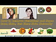 How to Get Clear Skin, Remove Blemishes and Scars from Skin Naturally