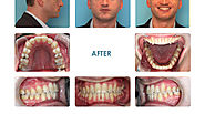 Orthodontics Gallery | Orthodontic Harmony | Briarcliff Manor New York