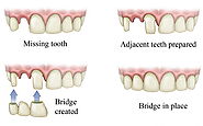 Treatment of Toothache services