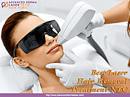 What Makes A Facial Hair Removal Laser Treatment The Best? ~ Advanced Derma Laser New York