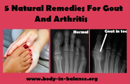 5 Natural Remedies For Gout And Arthritis