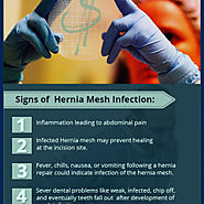 5 Signs of Infected Hernia Mesh.