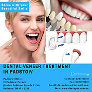 Dental Veneers Treatment - Dentapex at Stanhope Gardens & Padstow