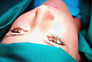 Questions to Ask to Find the Best Eye Surgeon in Orange County