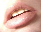 Best Cold Sores Treatment Tips to Make Your Lips Pink and Juicy | GNet Health and Fitness