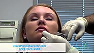 Lip Augmentation by Restylane Injections