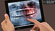 The Importance of Digital X-Ray in Dentistry – North Island Dental Arts