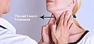 Thyroid Cancer Treatment in India