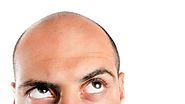 Hair Transplant - How to Decide for or Against