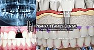 Implant Dentistry: The Best Dental Care Solution