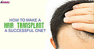 Avenues Cosmetics — How To Make A Hair Transplant A Successful One?