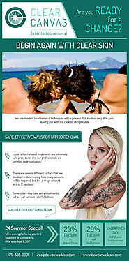 All Your Queries on Tattoo Removal Answered