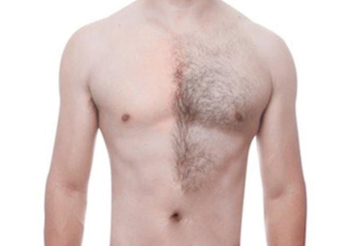 Hair removal tips and facts for men A Listly List