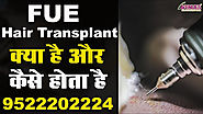 Best Hair Transplant in Ahmedabad:- Ahmedabad hair transplant is best place f...