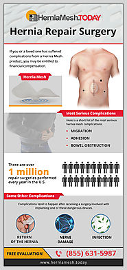 Getting Compensation For Hernia Mesh Complication