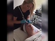 HYDRAFACIAL Treatment For Facial Cleansing at NOVA Plastic Surgery