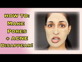 Deep Clean Your Pores - Make Pores Disappear and Clear Acne!