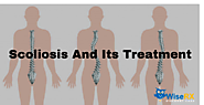 Scoliosis And Its Treatment