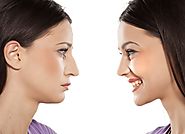 Nose Reshaping Surgery Guidelines