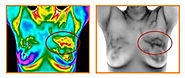 Medical Infrared Thermography Breast Cancer Screening Services — FLOW WELL