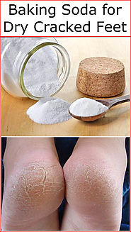 Baking Soda for Dry Cracked Feet | Baking Soda Uses and DIY Home Remedies.