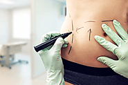 The Best Clinic to get Guaranteed Results for Body Contouring in Houston, Texas