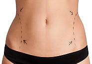 Non Surgical Body Contouring for a perfect body