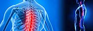 How to Find a Chiropractor in Brantford on the Internet
