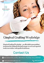 Gingival Grafting Weybridge