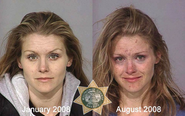 These Before And After Photos Of Drug Users Are Absolutely Horrifying. And Gross.