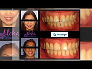 Orthodontist Las Vegas | aloha-orthodontics.com