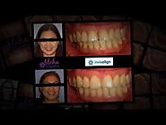 Summerlin Orthodontist | aloha-orthodontics.com