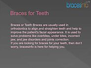 Braces For Teeth