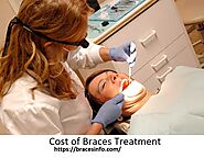 Dental Braces Cost