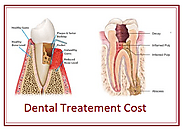 Dental Braces Treatment