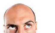 The Stages of Hair Loss