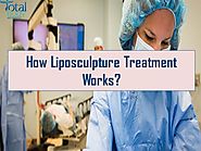 How Liposculpture Treatment Works