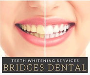 Everything You Need to Know About Teeth Whitening - bridgesdental