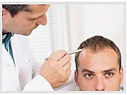 At What Stage You Need To Consult? What Type Of Doctors Treat Hair Loss And Its Cost? – avenueskapadia