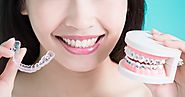 Invisalign: The New Dental Technology