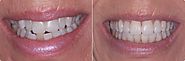 Dentist Maidstone | Cosmetic Dentistry | Teeth Straightening | Teeth Whitening | Smile Makeovers