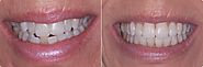 WHY CHOOSE ASCOT VALE SMILES?