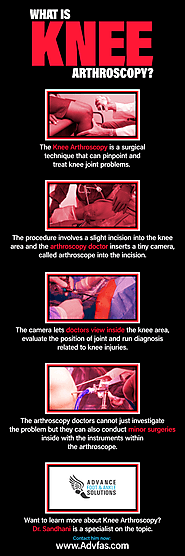 Knee Arthroscopy Infographic