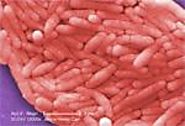 Bacteria and Viruses | FoodSafety.gov