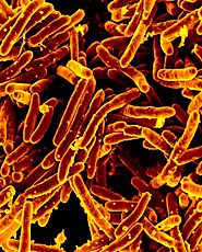 Types of Foodborne Pathogen and Bacteria Causing Illness | Pathogens 101