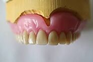 Answers to Some Common Questions Related To Complete Dentures