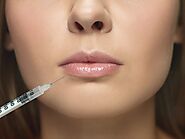 Understanding Lip Filler Swelling Stages: What to Expect