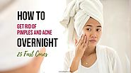 How to Get Rid of Pimples and Acne Overnight: 25 Fast Cures