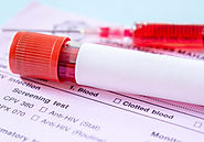 STD Screening: What You Need to Know